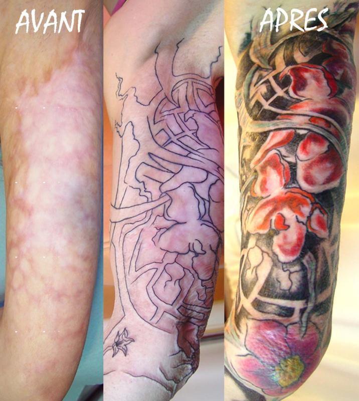 tattoo cacher brûlure avec floral